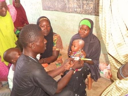 A malnurished VC indentified by organization NFP during Supportive Supervision at community Level Ningi